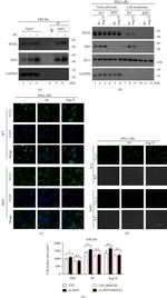 MLKL Antibody in Immunocytochemistry (ICC/IF)