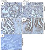 MMP16 Antibody in Immunohistochemistry (IHC)