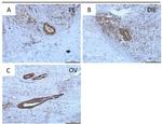 MMP16 Antibody in Immunohistochemistry (IHC)