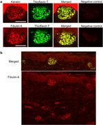 Cytokeratin 5 Antibody in Immunohistochemistry (IHC)