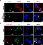 AKIP1 Antibody in Immunocytochemistry, Proximity Ligation Assay (PLA) (ICC/IF, PLA)