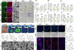 RUNX2 Antibody in Immunohistochemistry (IHC)