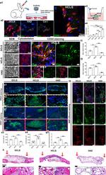 RUNX2 Antibody in Immunohistochemistry (IHC)