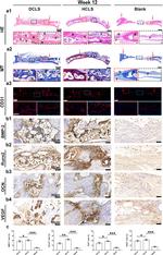 CD31 Antibody in Immunohistochemistry (IHC)