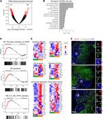 Granzyme B Antibody in Immunohistochemistry (IHC)