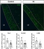 GFAP Antibody in Immunohistochemistry (IHC)