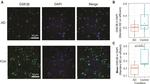 GSK3B Antibody in Immunohistochemistry (IHC)