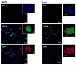 CD47 Antibody in Immunohistochemistry (Paraffin) (IHC (P))