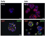 CD47 Antibody in Immunohistochemistry (Paraffin) (IHC (P))