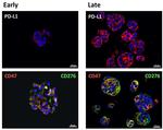 CD274 (PD-L1, B7-H1) Antibody in Immunohistochemistry (Paraffin) (IHC (P))