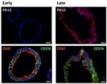 CD274 (PD-L1, B7-H1) Antibody in Immunohistochemistry (Paraffin) (IHC (P))