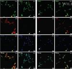 Vimentin Antibody in Immunocytochemistry (ICC/IF)