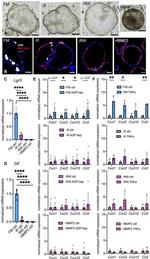 MUC5AC Antibody in Immunohistochemistry (Paraffin) (IHC (P))