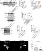 Phospho-STAT3 (Tyr705) Antibody in Western Blot (WB)