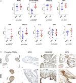 M-CSF Antibody in Immunohistochemistry (Paraffin) (IHC (P))