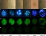 Estrogen Receptor alpha Antibody in Immunocytochemistry (ICC/IF)