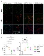 VWF Antibody in Immunocytochemistry (ICC/IF)