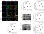 ADAMTS4 Antibody in Western Blot (WB)