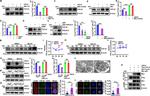 LC3B Antibody in Immunocytochemistry (ICC/IF)