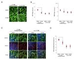 PMP70 Antibody in Immunocytochemistry (ICC/IF)