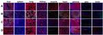 Endomucin Antibody in Immunohistochemistry (IHC)