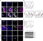 SARS/SARS-CoV-2 Nucleocapsid Antibody in Immunocytochemistry (ICC/IF)