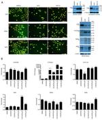 VDR Antibody in Immunocytochemistry (ICC/IF)