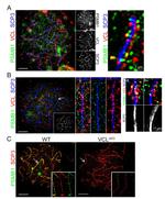 PSMB1 Antibody in Immunocytochemistry (ICC/IF)