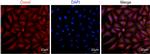 LECT1 Antibody in Immunocytochemistry (ICC/IF)