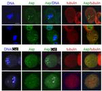 GFP Antibody in Immunocytochemistry (ICC/IF)