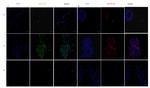 Nestin Antibody in Immunocytochemistry (ICC/IF)