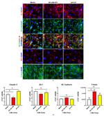 VE-cadherin Antibody in Immunocytochemistry (ICC/IF)