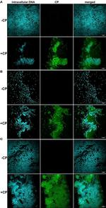 S100A8 Antibody in Immunocytochemistry (ICC/IF)