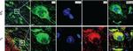 Rabbit IgG (H+L) Cross-Adsorbed Secondary Antibody in Immunohistochemistry (IHC)