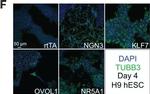 Mouse IgG (H+L) Cross-Adsorbed Secondary Antibody in Immunocytochemistry (ICC/IF)