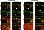 Mouse IgG (H+L) Cross-Adsorbed Secondary Antibody in Immunohistochemistry (IHC)