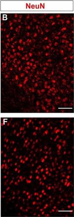 Mouse IgG (H+L) Cross-Adsorbed Secondary Antibody in Immunohistochemistry (IHC)