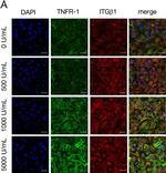 Mouse IgG (H+L) Cross-Adsorbed Secondary Antibody in Immunohistochemistry (IHC)