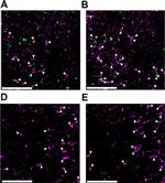 Rat IgG (H+L) Cross-Adsorbed Secondary Antibody in Immunohistochemistry (IHC)