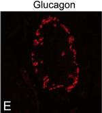 Guinea Pig IgG (H+L) Highly Cross-Adsorbed Secondary Antibody in Immunocytochemistry (ICC/IF)