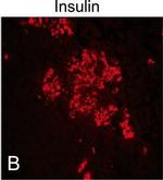 Guinea Pig IgG (H+L) Highly Cross-Adsorbed Secondary Antibody in Immunocytochemistry (ICC/IF)