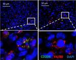 Rat IgG (H+L) Cross-Adsorbed Secondary Antibody in Immunohistochemistry (Paraffin) (IHC (P))