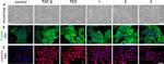 Rabbit IgG (H+L) Cross-Adsorbed Secondary Antibody in Immunocytochemistry (ICC/IF)