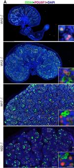 Goat IgG (H+L) Cross-Adsorbed Secondary Antibody in Immunohistochemistry (IHC)