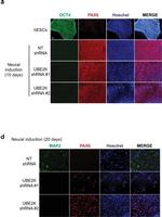 Mouse IgG (H+L) Highly Cross-Adsorbed Secondary Antibody in Immunocytochemistry (ICC/IF)