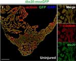 Mouse IgG (H+L) Highly Cross-Adsorbed Secondary Antibody in Immunohistochemistry (IHC)