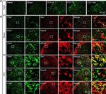 Rabbit IgG (H+L) Cross-Adsorbed Secondary Antibody in Immunohistochemistry (Frozen) (IHC (F))