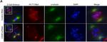 Mouse IgG (H+L) Highly Cross-Adsorbed Secondary Antibody in Immunocytochemistry (ICC/IF)