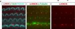 Mouse IgG (H+L) Highly Cross-Adsorbed Secondary Antibody in Immunohistochemistry (IHC)