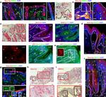 Mouse IgG (H+L) Highly Cross-Adsorbed Secondary Antibody in Immunohistochemistry (Paraffin) (IHC (P))